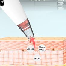 將圖片載入圖庫檢視器 Vacuum Acne Extractor Facial Pore Cleanser The rechargeable design is convenient for repeated