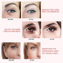 將圖片載入圖庫檢視器 Beauty Instrument RF RadioFrequency Facial LED Photon Skin Care