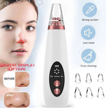 將圖片載入圖庫檢視器 Acne Pore Cleaner Pimple Removal Vacuum Suction Facial Tools
