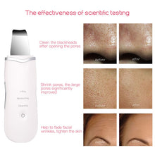 將圖片載入圖庫檢視器 Ultrasonic Facial Skin Scrubber Ion Deep Face Cleaning Peeling Rechargeable
