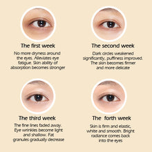 將圖片載入圖庫檢視器 Cream Removal Dark Circle Anti-Wrinkle Eye Bags Repair Crocodile Eye Serum Peptide Collagen
