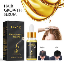 將圖片載入圖庫檢視器 Ginger Fast Hair Growth Serum Essential Oil Anti Preventing Hair Lose Liquid Damaged Hair Repair

